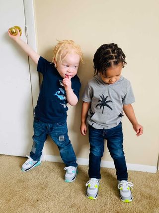 people dont think my black toddler and my son who is albino are identical twins 34770 1