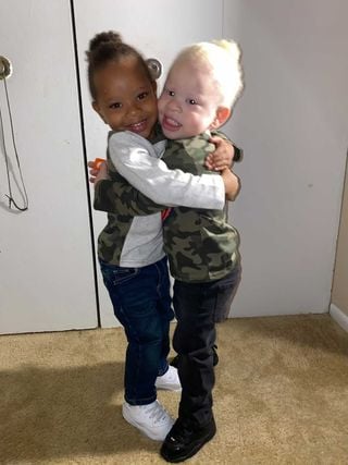 people dont think my black toddler and my son who is albino are identical twins 34770 2